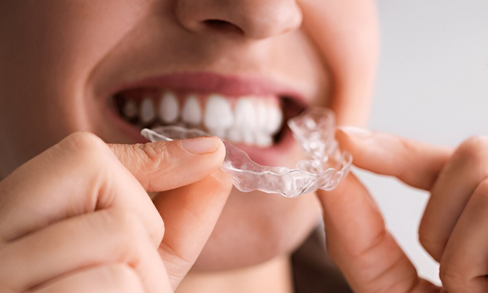 night-guard-edmonton