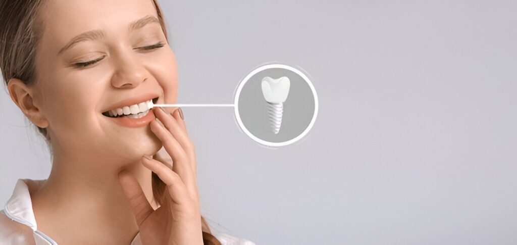 Tooth Implants Edmonton