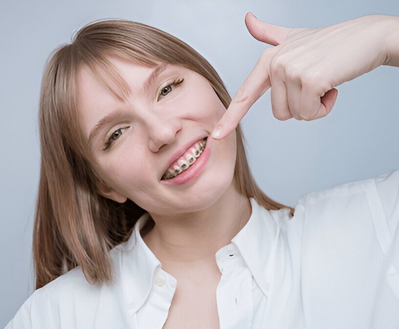 Ceramic Braces Edmonton